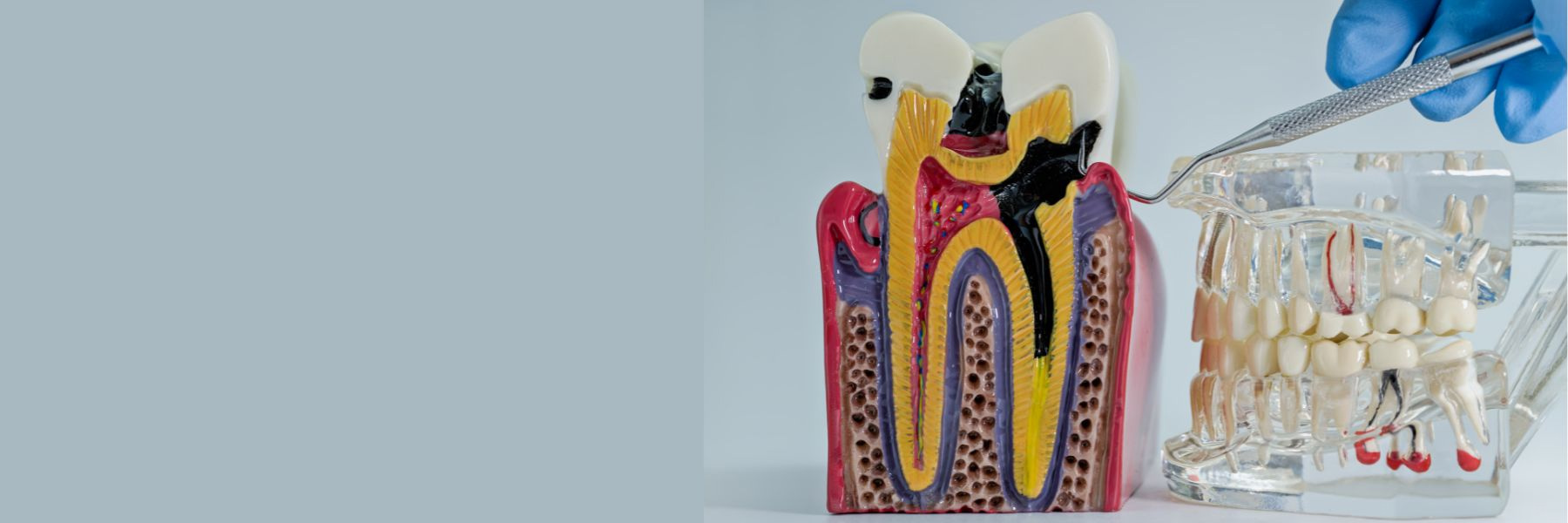 Tooth Extractions | Dentist